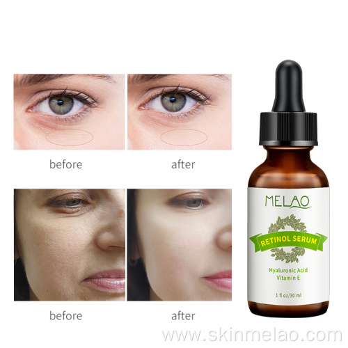 Skin Care Pure Organic Retinol Serum